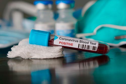 crisis coronavirus